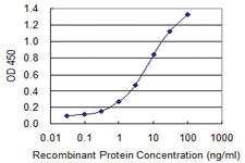 Anti-SERPINB1 Mouse Monoclonal Antibody [clone: 4A7]