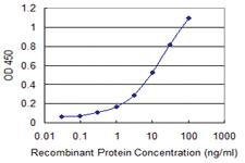 Anti-IKBKE Mouse Monoclonal Antibody [clone: 2F1]