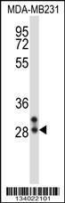 Anti-NEUROG2 Rabbit Polyclonal Antibody (Biotin)