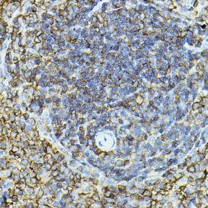 Immunohistochemistry analysis of paraffin-embedded rat spleen using Anti-CD79a Antibody (A8388) at a dilution of 1:100 (40X lens). Perform high pressure antigen retrieval with 10 mM citrate buffer pH 6.0 before commencing with IHC staining protocol