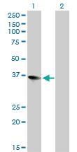 Anti-ZFP36L1 Mouse Monoclonal Antibody [clone: 1A3]