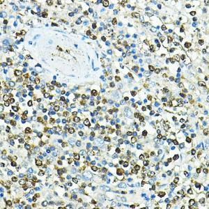 Immunohistochemistry analysis of paraffin-embedded human spleen using Anti-CD79a Antibody (A8388) at a dilution of 1:100 (40X lens). Perform high pressure antigen retrieval with 10 mM citrate buffer pH 6.0 before commencing with IHC staining protocol