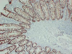 Immunohistochemical analysis of paraffin-embedded human Colon using Anti-TGF beta Receptor I Antibody