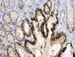 Anti-Estrogen Inducible Protein Ps2 Rabbit Polyclonal Antibody