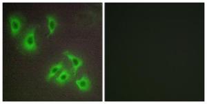 Immunofluorescence analysis of HepG2 cells using Anti-BCLW Antibody. The right hand panel represents a negative control, where the antibody was pre-incubated with the immunising peptide