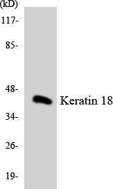 Western blot analysis of the lysates from COLO205 cells using Anti-Keratin 18 Antibody