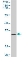 Anti-ELAVL1 Rabbit Polyclonal Antibody