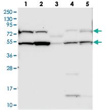 Anti-C10ORF90 Rabbit Polyclonal Antibody