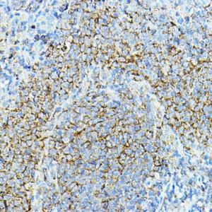 Immunohistochemistry analysis of paraffin-embedded mouse spleen using Anti-CD79a Antibody (A8388) at a dilution of 1:100 (40X lens). Perform high pressure antigen retrieval with 10 mM citrate buffer pH 6.0 before commencing with IHC staining protocol