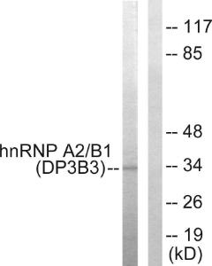 Western blot analysis of lysates from HepG2 cells using Anti-hnRNP A2 + B1 Antibody. The right hand lane represents a negative control, where the antibody is blocked by the immunising peptide