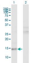 Anti-LRRFIP1 Mouse Polyclonal Antibody