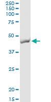 Anti-TMOD2 Polyclonal Antibody Pair