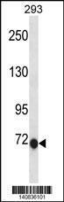 Anti-CLIC6 Rabbit Polyclonal Antibody (AP (Alkaline Phosphatase))