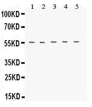 Anti-TACR1 Rabbit Polyclonal Antibody