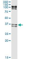 Anti-ELAVL1 Rabbit Polyclonal Antibody