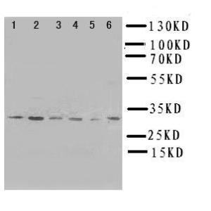 Anti-Apoptosis repressor with CARD Rabbit Polyclonal Antibody