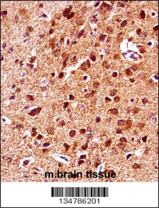 Anti-GSK3B Rabbit Polyclonal Antibody (HRP (Horseradish Peroxidase))