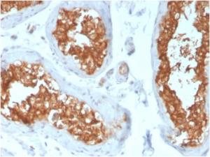 Immunohistochemical analysis of formalin-fixed, paraffin-embedded human testis using Anti-Vinculin Antibody [VCL/3617]