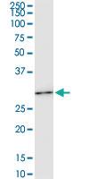 Anti-HOXC6 Mouse Monoclonal Antibody [clone: 2A4]