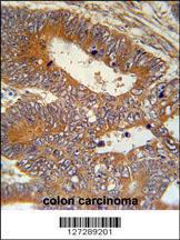 Anti-MAP1S Rabbit Polyclonal Antibody (FITC (Fluorescein Isothiocyanate))