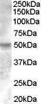 Anti-ESRRG Antibody (A83163) (0.2 µg/ml) staining of Human Breast lysate (35 µg protein in RIPA buffer). Primary incubation was 1 hour. Detected by chemiluminescence