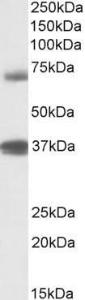 Anti-TRIM29 Antibody (A84758) (1µg/ml) staining of Peripheral Blood Mononucleocyte lysate (35µg protein in RIPA buffer). Primary incubation was 1 hour. Detected by chemiluminescence.