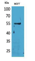 Western blot analysis of MCF7 cells using Anti-LILRA4 Antibody