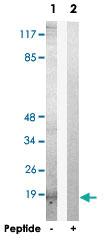 Anti-TP53I11 Rabbit Polyclonal Antibody