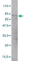 Anti-CTNNA3 Mouse Monoclonal Antibody [clone: 3F4-1B11]