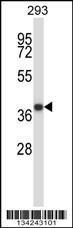 Anti-MOAP1 Rabbit Polyclonal Antibody (HRP (Horseradish Peroxidase))