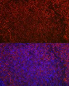 Immunofluorescence analysis of rat spleen using Anti-CD79a Antibody (A8388) at a dilution of 1:50 (40X lens). DAPI was used to stain the cell nuclei (blue)