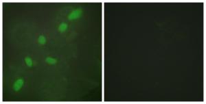 Immunofluorescence analysis of HeLa cells using Anti-hnRNP A2 + B1 Antibody. The right hand panel represents a negative control, where the antibody was pre-incubated with the immunising peptide