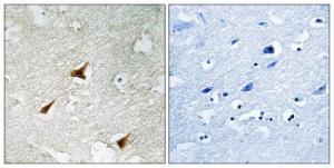 Immunohistochemical analysis of paraffin-embedded human brain using Anti-p19 INK4d Antibody. The right hand panel represents a negative control, where the antibody was pre-incubated with the immunising peptide