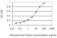 Anti-HOXC6 Mouse Monoclonal Antibody [clone: 2A4]