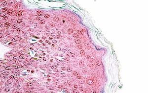 Anti-TRIM29 Antibody (A84758) (3.75µg/ml) staining of paraffin embedded Human Skin. Steamed antigen retrieval with citrate buffer pH 6, AP-staining.