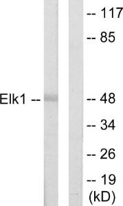 Western blot analysis of lysates from HeLa cells using Anti-Elk1 Antibody. The right hand lane represents a negative control, where the antibody is blocked by the immunising peptide