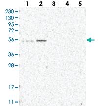 Anti-IQCC Rabbit Polyclonal Antibody