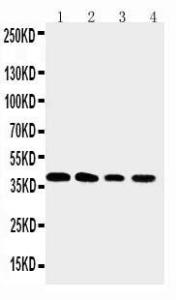 Anti-XRCC3 Rabbit Polyclonal Antibody