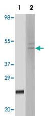 Anti-FBLN5 Mouse Monoclonal Antibody [clone: 3F10A5,3F8A12]