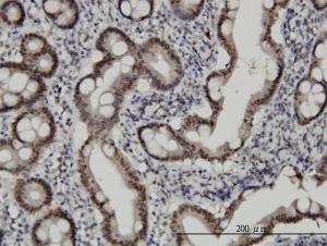 Anti-CHFR Mouse Monoclonal Antibody [clone: 1H3-A12]