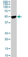 Anti-TTC8 Mouse Monoclonal Antibody [clone: 7E2]