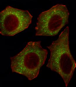 Anti-CACNA2D2 Rabbit Polyclonal Antibody (HRP (Horseradish Peroxidase))