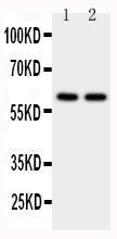 Anti-CYP11A1 Rabbit Polyclonal Antibody