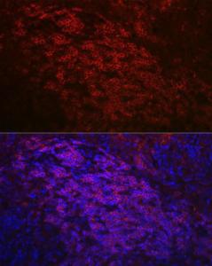 Immunofluorescence analysis of mouse spleen using Anti-CD79a Antibody (A8388) at a dilution of 1:50 (40X lens). DAPI was used to stain the cell nuclei (blue)