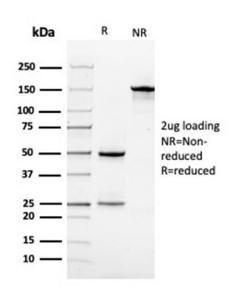 SDS-PAGE analysis of Anti-Vinculin Antibody [VCL/3617] under non-reduced and reduced conditions; showing intact IgG and intact heavy and light chains, respectively. SDS-PAGE analysis confirms the integrity and purity of the Antibody