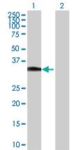 Anti-HOXC8 Rabbit Polyclonal Antibody