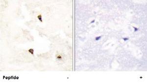 Anti-TP53I11 Rabbit Polyclonal Antibody