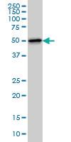 Anti-TTC8 Mouse Monoclonal Antibody [clone: 7E2]