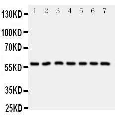 Anti-CYP11B1 Rabbit Polyclonal Antibody