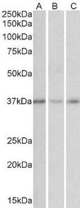 Anti-GHITM Antibody (A84759) (0.01µg/ml) staining of Human Cerebellum (A), Duodenum (B) and Heart (C) cell lysates (35µg protein in RIPA buffer). Primary incubation was 1 hour. Detected by chemiluminescence.